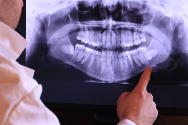 Best Emergency Denture Repair in Unionville, GA