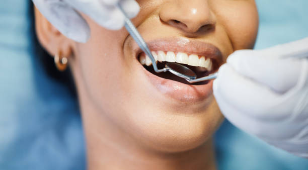 Best Broken or Chipped Tooth Repair in Unionville, GA